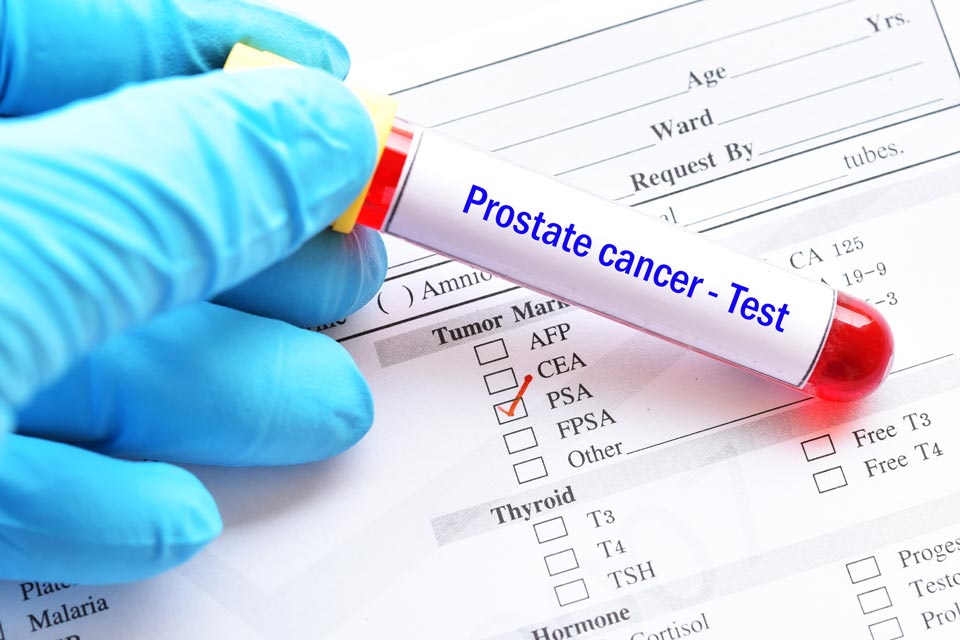 Research suggests turmeric compounds could help fight prostate cancer.