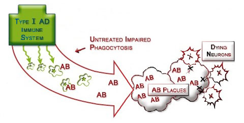 Figure IV.9: Impaired Immune-Phagocytosis System in Alzheimer's Disease