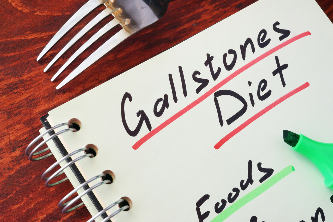 What causes gallstones?