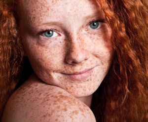 Girl with freckles