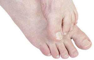 Herbal skin treatment Herbal skin treatment