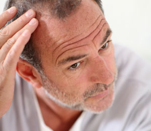 Man checking hair loss