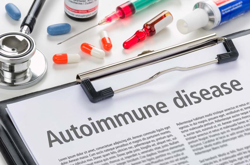 Sjögren's Syndrome is an Autoimmune Disease Turmeric compounds may help patients with Sjögren's Syndrome.