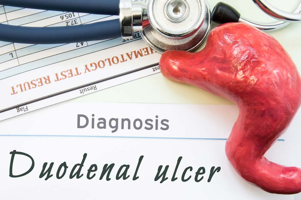 Turmeric Compounds May Help Stomach Ulcers Phellandrene compounds in turmeric may help treat stomach (duodenal) ulcers.