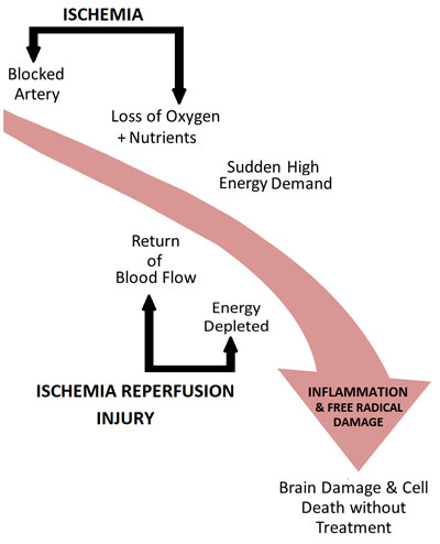 Figure IV.24: Chain of Events in a Stroke