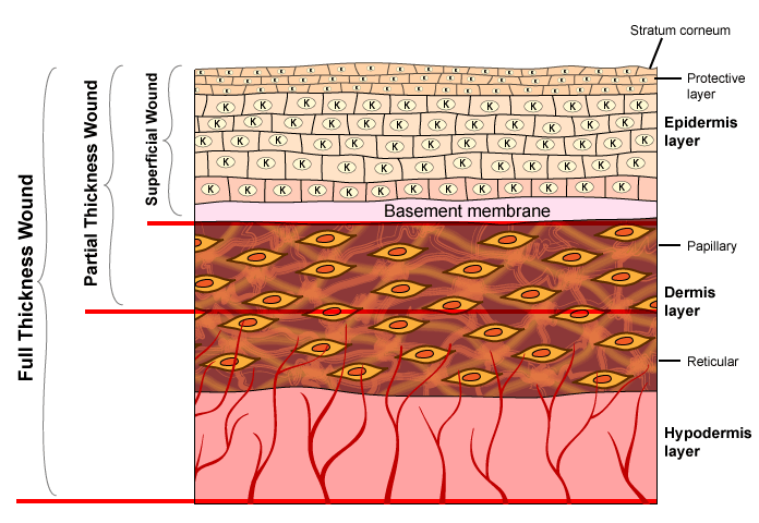 Figure IX.1: Severity of Wounds