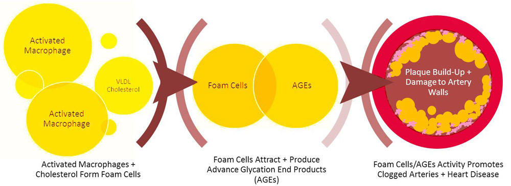 Diagram of plaque build-up in arteries