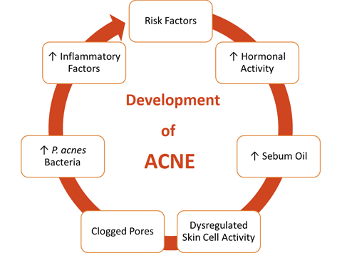 How Do Pimples Form?